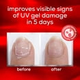 thumbnail image 3 of Tratamiento de uñas Essie UV Gel Damage Repair, 13,6 ml, 3 of 9