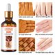 thumbnail image 3 of Suero blanqueador rápido para nudillos oscuros, Corrector de melanina para nudillos de manos y codos, productos para el cuidado de la belleza, 50ml, 3 of 5