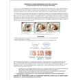 thumbnail image 5 of Guarda Bucal Anti Ronquidos PARATO2 Tecnología de Bloqueo Ajuste Personalizado MULTIPLE AJUSTE, 5 of 5