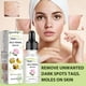 thumbnail image 2 of Mole Removal Serum 3Pcs Herb Plant Extracts Mole Corrector Skin Tag Remover Remove Moles with No Scars, 2 of 5