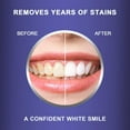 thumbnail image 5 of MySmile Teeth Whitening Strips with 28-LED Light, 28pcs 6%HP White Strips Teeth Whitening Kit, Tooth Whitener Remove 10 years of Stain,14 Treatments, 5 of 11