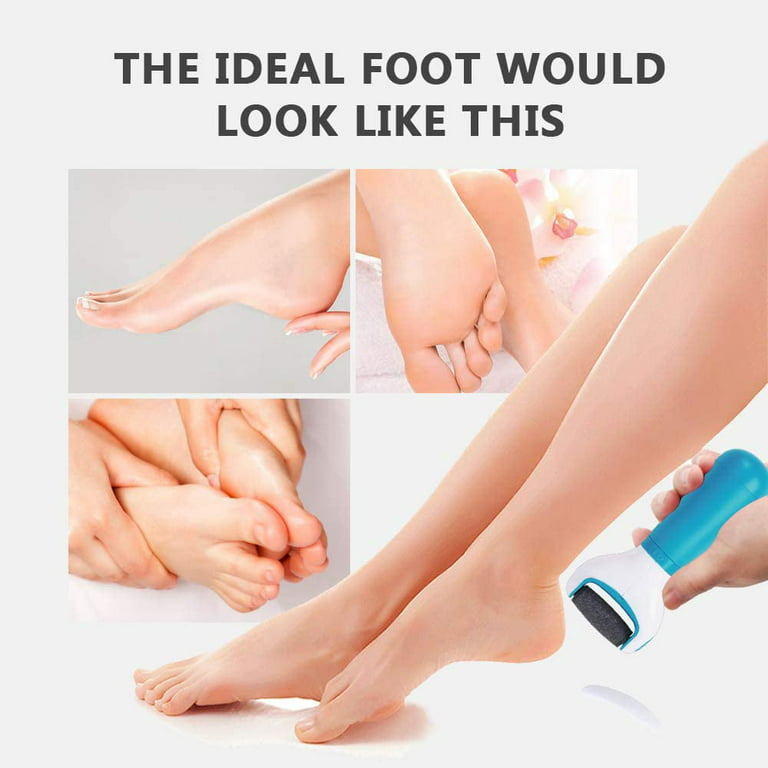 Electric Foot File Scraper Callus Remover Feet Professional Matte Pedicure  Tools Foot Corn Removal Dead Skin Remover Foot Care - AliExpress