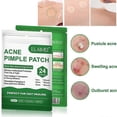 thumbnail image 1 of Parche para acné, invisible, profesional, absorbente, para cubrir las espinillas, para hombres y mujeres, cuidado de la piel del rostro, 1 of 5