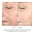 thumbnail image 4 of Epionce Purifying Toner 4oz, 4 of 5