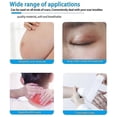 thumbnail image 3 of Scar Patches for Facial Wrinkles, Cesarean Section Scar Patches, 3 of 5