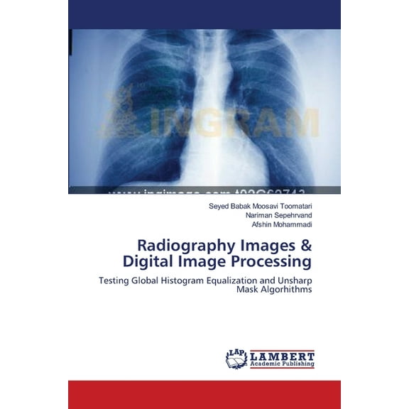 Radiography Images & Digital Image Processing (Paperback)