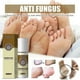 thumbnail image 2 of Anti Fungal Infections Fungus Combat Feet Spray Athlete's Foot Spray, 2 of 5