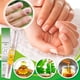 thumbnail image 4 of Pluma De Tratamiento De Uñas 5ml 1 ANGGREK Nail Fungal Pen, 4 of 7