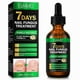 thumbnail image 1 of Nail Fungus Treatment Oil for Toenail & Cuticle Care, 7-Day Ginger Formula, 1/2/3 Pieces Fungal Nail Solution, 1 of 5