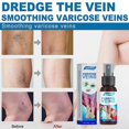 thumbnail image 3 of Varicose Vein Massage Spray Relieve Varices and Smooth Vascular Protrusions, 3 of 3