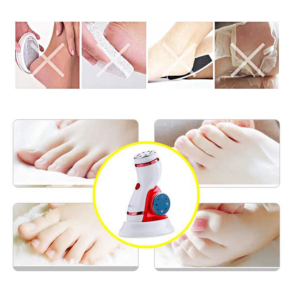 Dr.pedi Electric Foot File, Rechargeable Callus Remover for Feet & Toes, Pedi Care Tool with 4 Interchangeable Heads, Waterproof for Shower Use, USB Charging