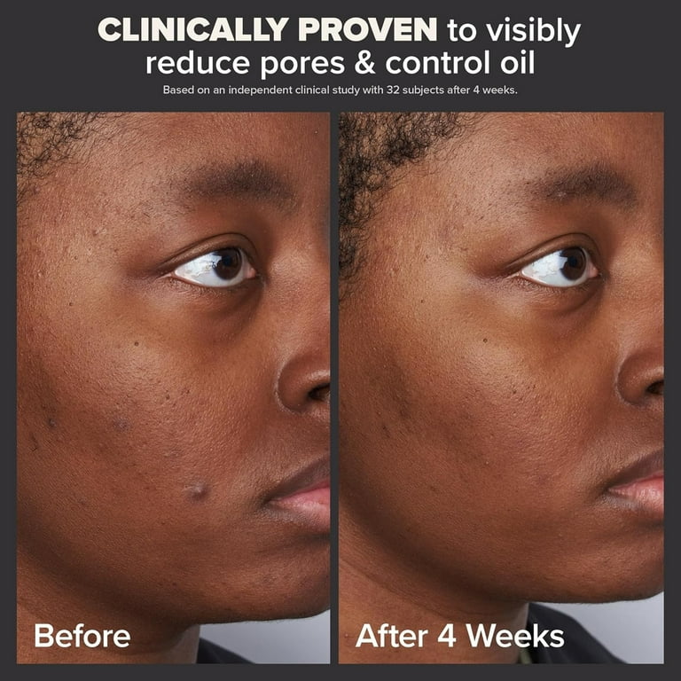 SKIN PERFECTING 2% Salicylic Acid Exfoliant - Facial Exfoliant for Blackheads, Pores