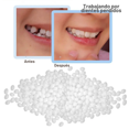 thumbnail image 3 of 2 Pack Perlas Adhesivas Moldea Dientes Sonrisa Perfecta, 3 of 7