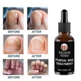 thumbnail image 2 of 2pcs Anti Fungal Nail Treatment Repair Finger Toe Care Nail Fungus Liquid, 2 of 4