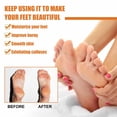 thumbnail image 4 of Cremas y lociones para manos, exfoliante para pies - 30 ml, potente - gel súper fuerte, efecto para pies y pies - productos para piel agrietada y muerta, 4 of 9