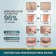 thumbnail image 2 of Láminas de silicona para cicatrices, cinta de silicona para eliminar queloides (rollo de 2 x 100 cm) - Cinta para cicatrices quirúrgicas, cesárea, abdominoplastia, quemaduras y acné., 2 of 5