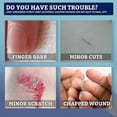 thumbnail image 2 of Liquid Band-aid Liquid Dressing Transparent Wound Dressing Wound Surface Protection Film-forming Band-ai, 2 of 5