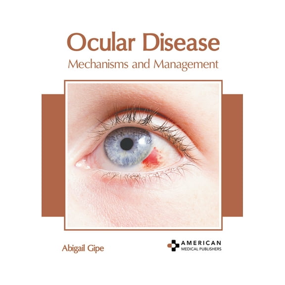 Ocular Disease: Mechanisms and Management, (Hardcover)