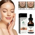 Vitamin C Serum for Face Fragrance Free Vitamin C Serum with Hyaluronic Acid Snail Mucin 96