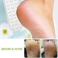 thumbnail image 4 of Lima para pies, removedor de vello de pies de doble cara, exfoliante para tratamiento de pies de acero inoxidable, 4 of 6