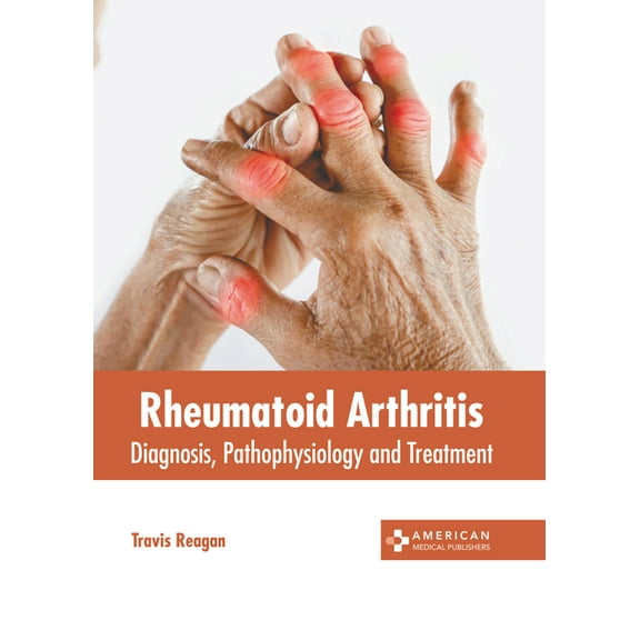 Rheumatoid Arthritis: Diagnosis, Pathophysiology and Treatment, (Hardcover)