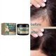 thumbnail image 2 of Hair Regrowth Dandruff Removal Itching Relieving Scalp Massage Hair, 2 of 5