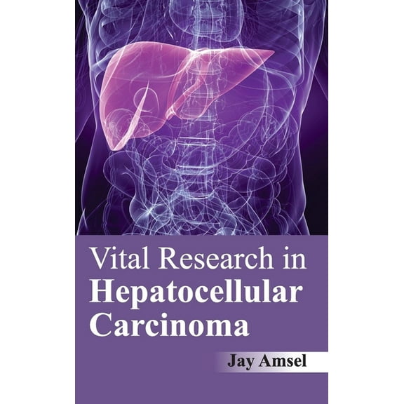 Vital Research in Hepatocellular Carcinoma, (Hardcover)