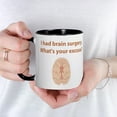 thumbnail image 3 of CafePress - I Had Brain Surgery. What's Mug - 11 oz Ceramic Mug - Novelty Coffee Tea Cup, 3 of 3