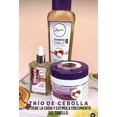 thumbnail image 5 of Anyeluz Trio de Cebolla,Shampoo de Cebolla,Terapia Capilar Crecimiento y Tonico, 5 of 12