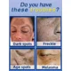 thumbnail image 5 of Removedor de manchas oscuras para la cara, eliminación de pecas, placas seniles, quemadura solar, crema para pecas, 5 of 5