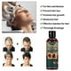 thumbnail image 4 of Champú anticaída JShteea para el crecimiento del cabello hombres y mujeres, 4 of 9