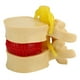 thumbnail image 2 of Modelo De Hernia De Disco Lumbar Humano, Portátil Profesional Práctico 1:1.5 Vértebras Lumbares Humanas Degenerativas, Enseñanza Clínica Para Ortopedia, 2 of 7