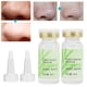 thumbnail image 4 of Solución para puntos negros suero para reducir los poros suero para eliminar puntos negros para niñas y mujeres para el cuidado de la piel ANGGREK Otros, 4 of 8