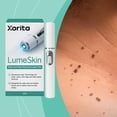 thumbnail image 4 of SharkTRUE Effective Skin Care Pen: Lightweight, Safe & Precise Blemish Removal, 4 of 8