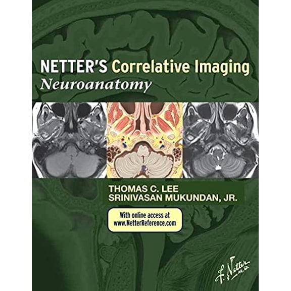 Pre-Owned Netters Correlative Imaging: Neuroanatomy: with NetterReference.com Access (Netter Clinical Science), 9781437704150, 1437704158, Hardcover, 1 edition