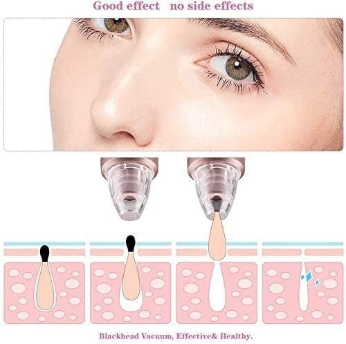RKXQT Blackhead Remover Pore Vacuum, Electric Facial Pore Cleaner Acne Comedone Removal USB Rechargeable Blackhead Extractor Tool with 3 Heads and Blackhead Remover Kit Suction
