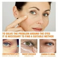 repairing-eye-to-lighten-the-bags-under-the-dark-and-improves-the-fine