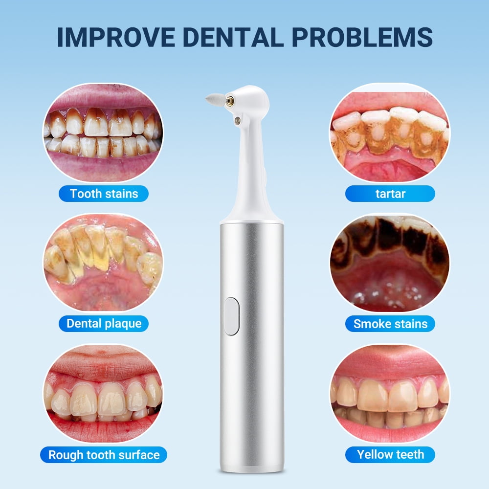 Tooth Polisher,Electric Teeth Polisher Professional with 5 Brush Heads, USB Tooth Whitening Kit, Plaque Remover with LED Light, Dental Polisher for Adults & Kids White