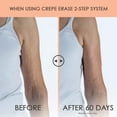 thumbnail image 3 of Crepe Erase Tratamiento avanzado para el cuidado del cuerpo en 2 pasos Cuidado de la piel antienvejecimiento para el cuerpo y el cuello Crema hidratante reafirmante + pretratamiento exfoliante corpora, 3 of 7