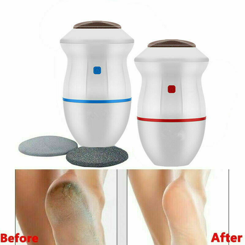 Electric Vacuum Foot Grinder File Machine Exfoliate Dead Skin Callus