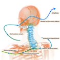 thumbnail image 2 of Neck Brace - Anti Snore Neck Brace Relief Neck Pain -, 2 of 5