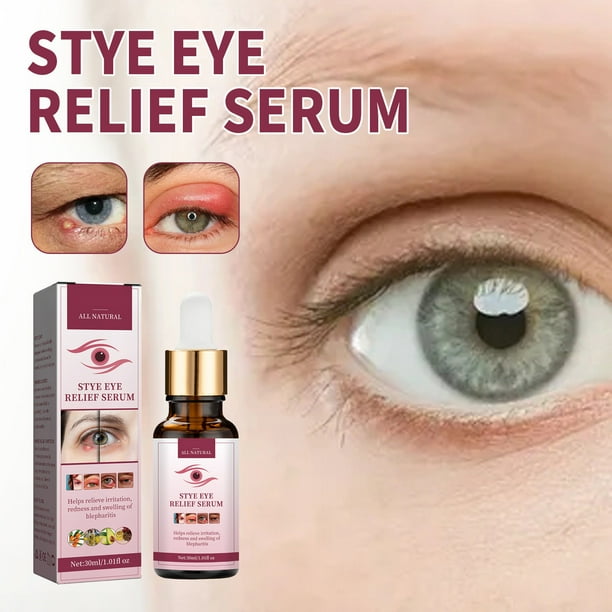 Eye Stye Remover Stye Eye Chalazion Remover for Styes Chalazion And