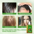 thumbnail image 4 of Pisexur Belleza Maquillaje Champú de aceite Nutre y regenera el cabello - Suave y para hombres y mujeres 300 mlpara mujeres y hombres, 4 of 5