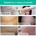 thumbnail image 3 of Scar Removal Cream Scar Cream Stretch Marks Removal Cream Scar Treatment Cream Scar Stretch Marks Scar Removal Cream Stretch Marks Remover Cream Scar Repair Removal Cream, 3 of 8