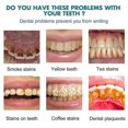 thumbnail image 2 of Blanqueamiento de dientes, pintura blanqueadora de dientes, esmalte de dientes Uptight White, suero de limpieza de dientes para eliminar manchas de blanqueamiento de esmalte de dientes, 2 piezas, 2 of 5