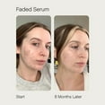 thumbnail image 5 of Topicals Faded & Clearing Serum 50 ml/ 1.7 fl oz, 5 of 5