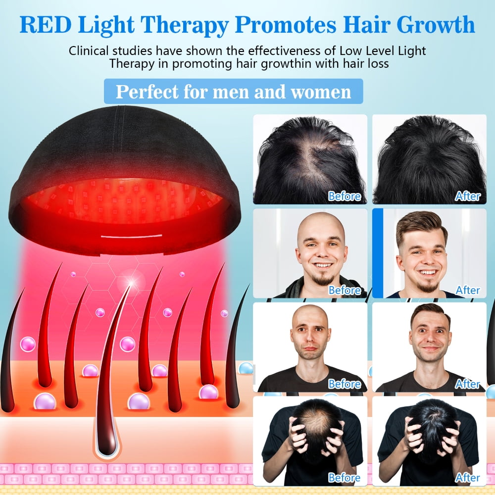 KTS Red Light Therapy Laser Cap - Cleared Low Level Laser Therapy Hair Regrowth for Men & Women, Hair Loss Treatment for Androgenetic Alopecia - KTS Red Light Therapy Laser Cap - Cleared Low Level Laser Therapy Hair Regrowth for Men & Women, Hair Loss Treatment for Androgenetic Alopecia -