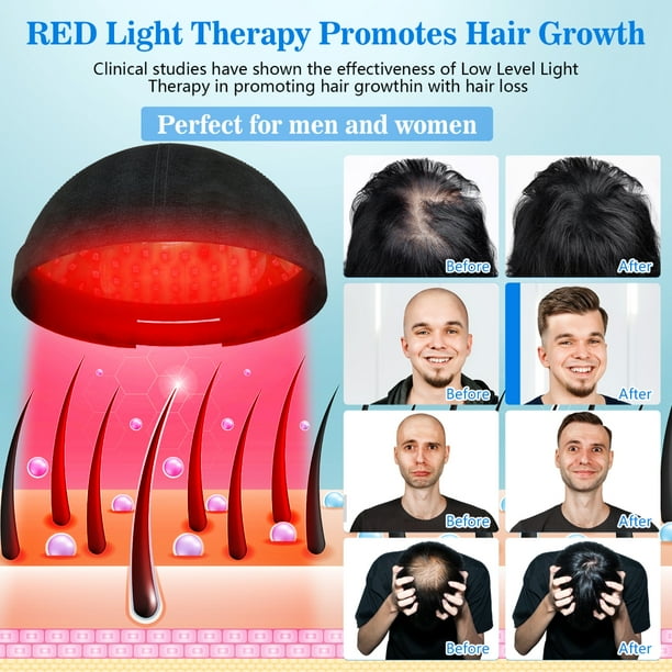 KST LED & Blue Light Therapy Hat for Reduce Loss Hair Growth Improve Hair Quality - Walmart.com