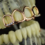 14K Rose Gold Plated Grillz Top All Four 4 Open Face Teeth Bling Hollow Hip Hop Grills