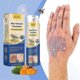 thumbnail image 2 of Bee-Venom Psoriasises Care Spray Anti-Itch Multi-Symptom Liquid Redness Relief Spray for All Skin Type, 2 of 5